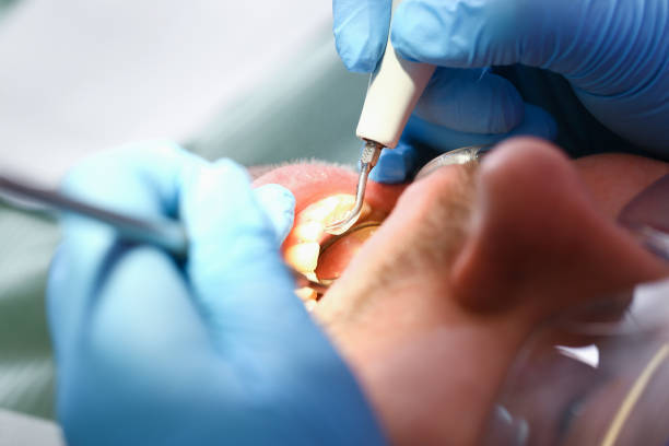Best Emergency Root Canal Treatment in Mountain Lake Park, MD